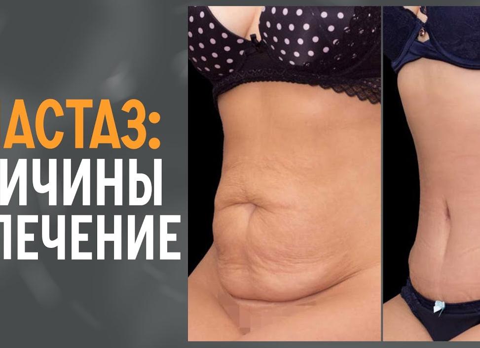 Как определить и избавиться от родовой порчи 